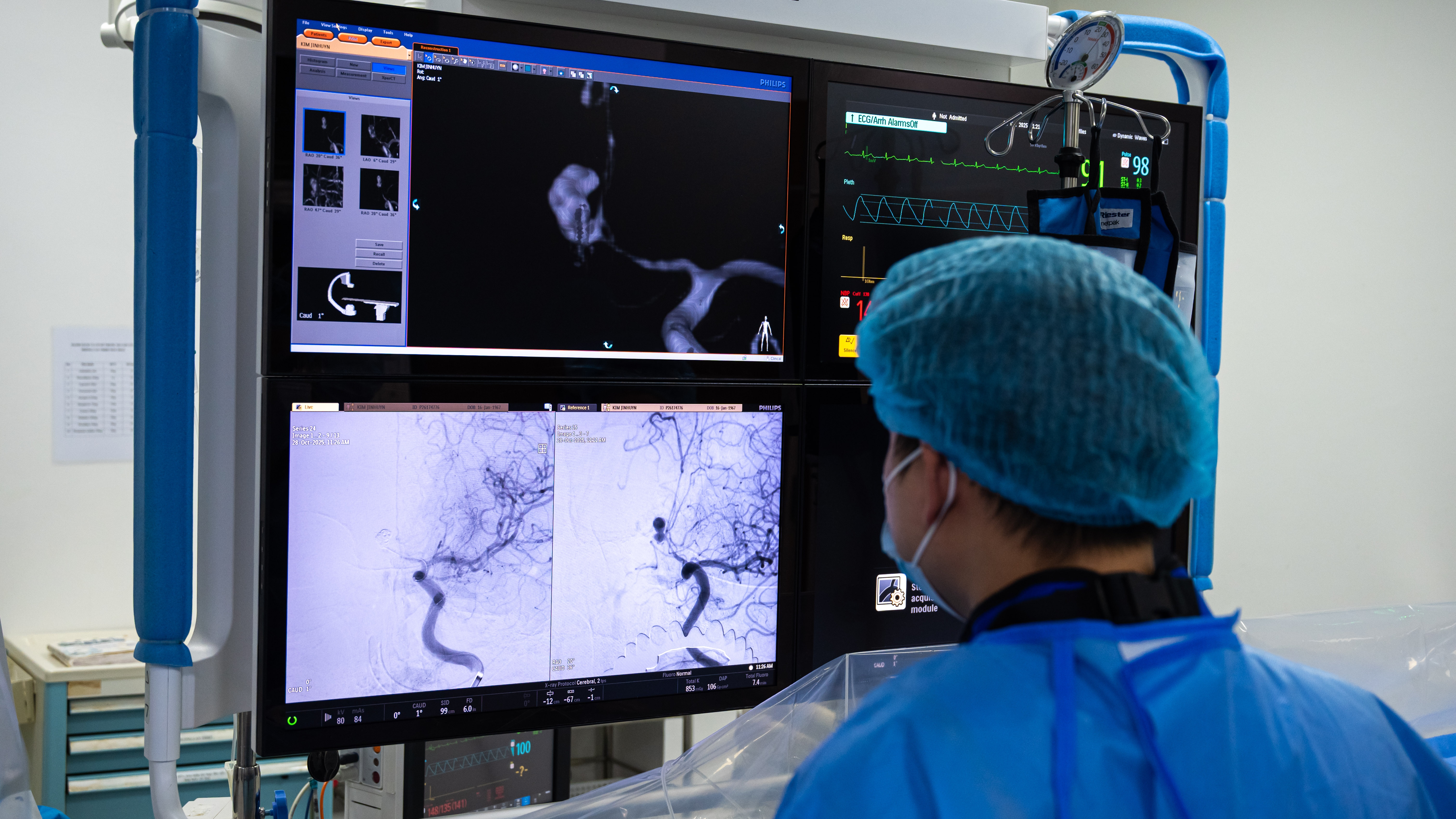 trong phong can thiep nao anh 23