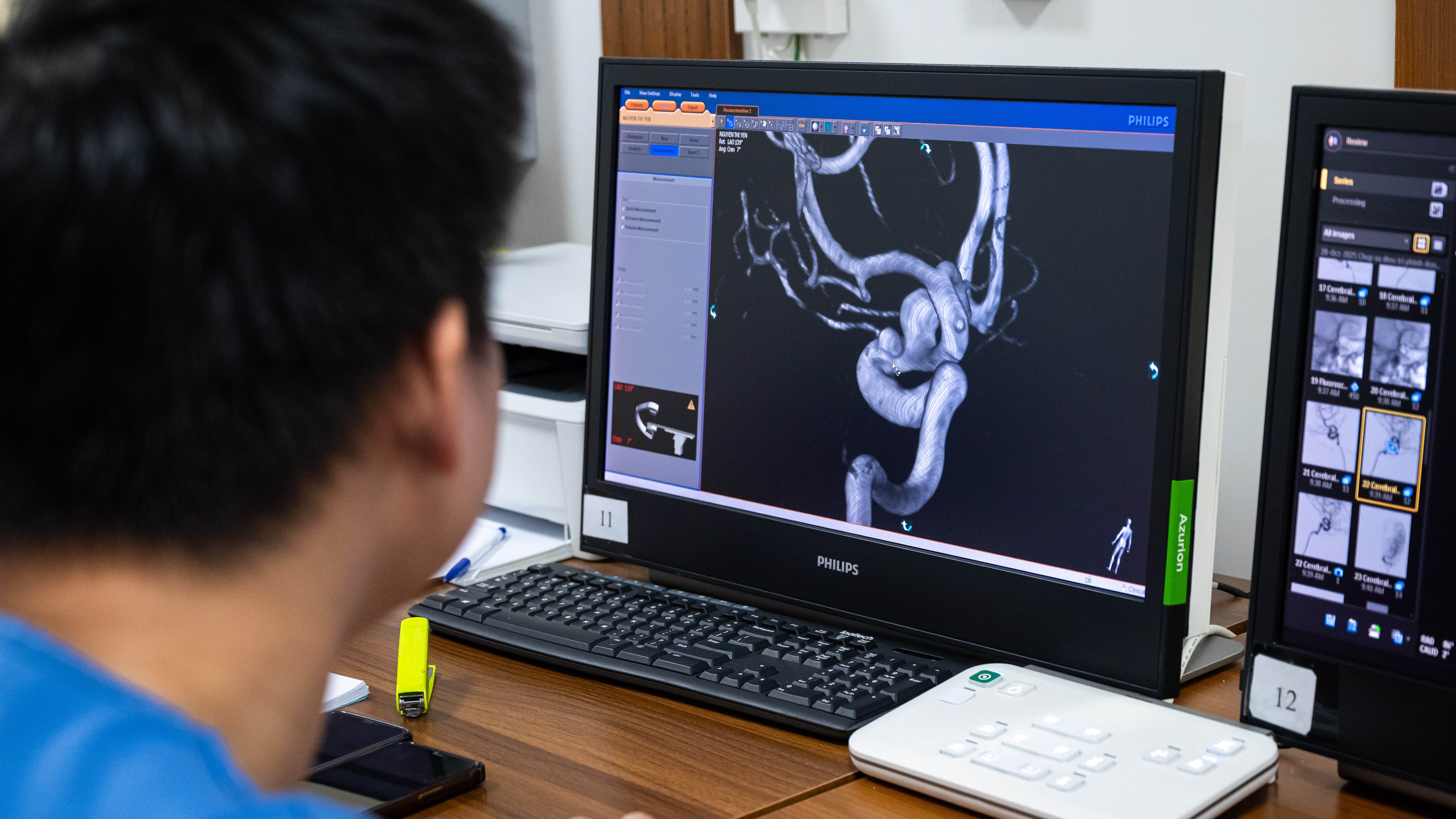 trong phong can thiep nao anh 9