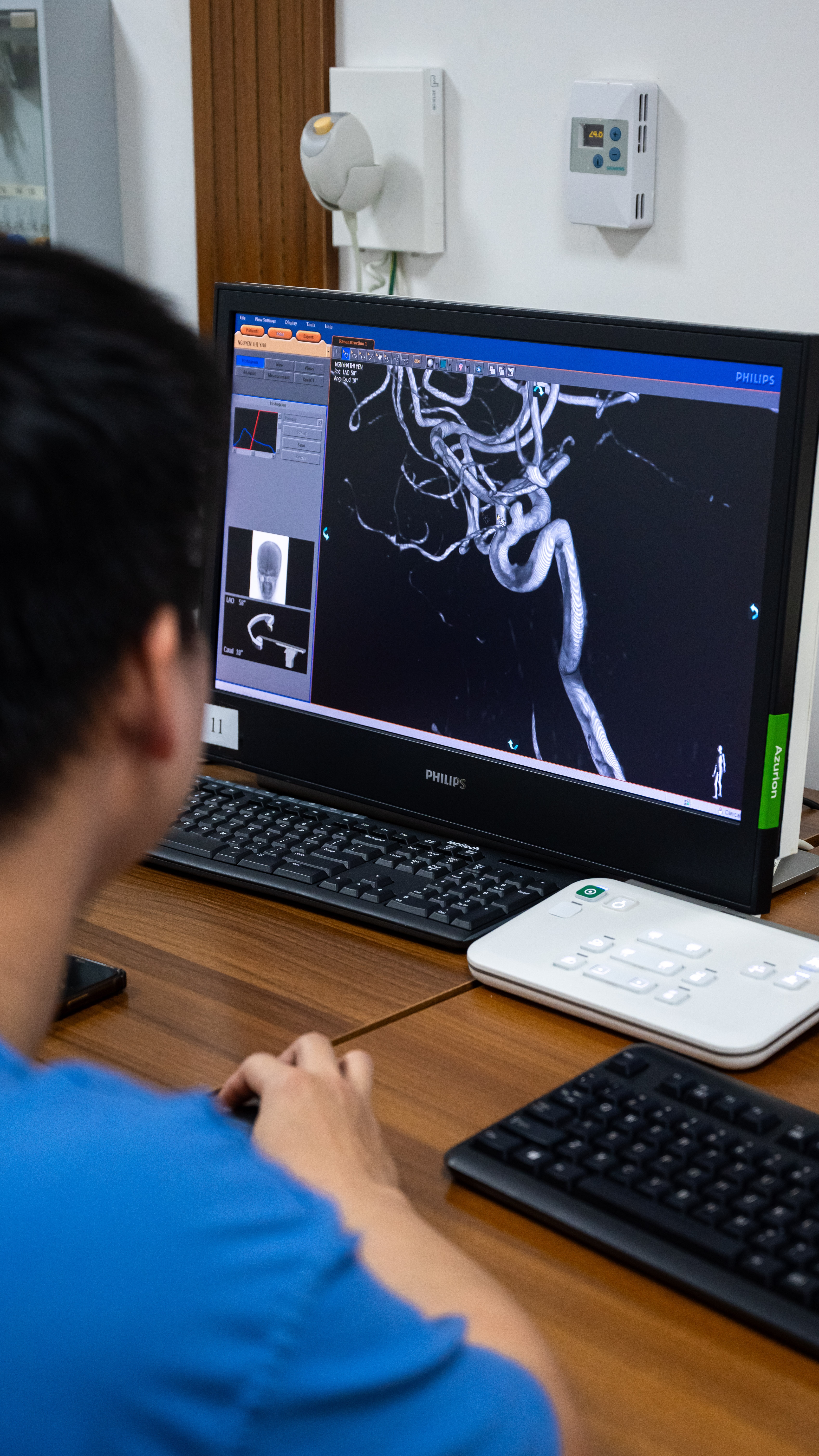 trong phong can thiep nao anh 10