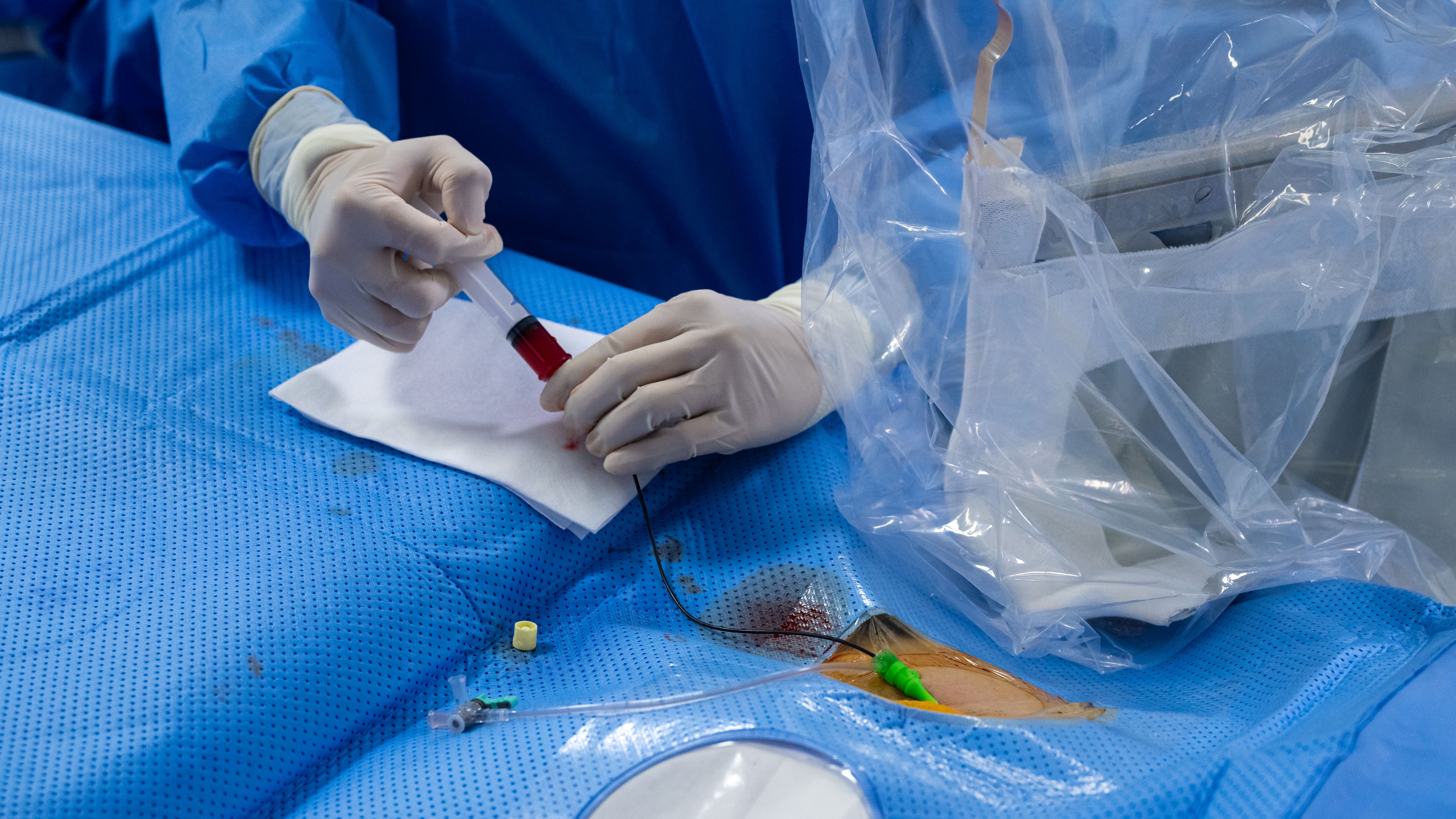 trong phong can thiep nao anh 19