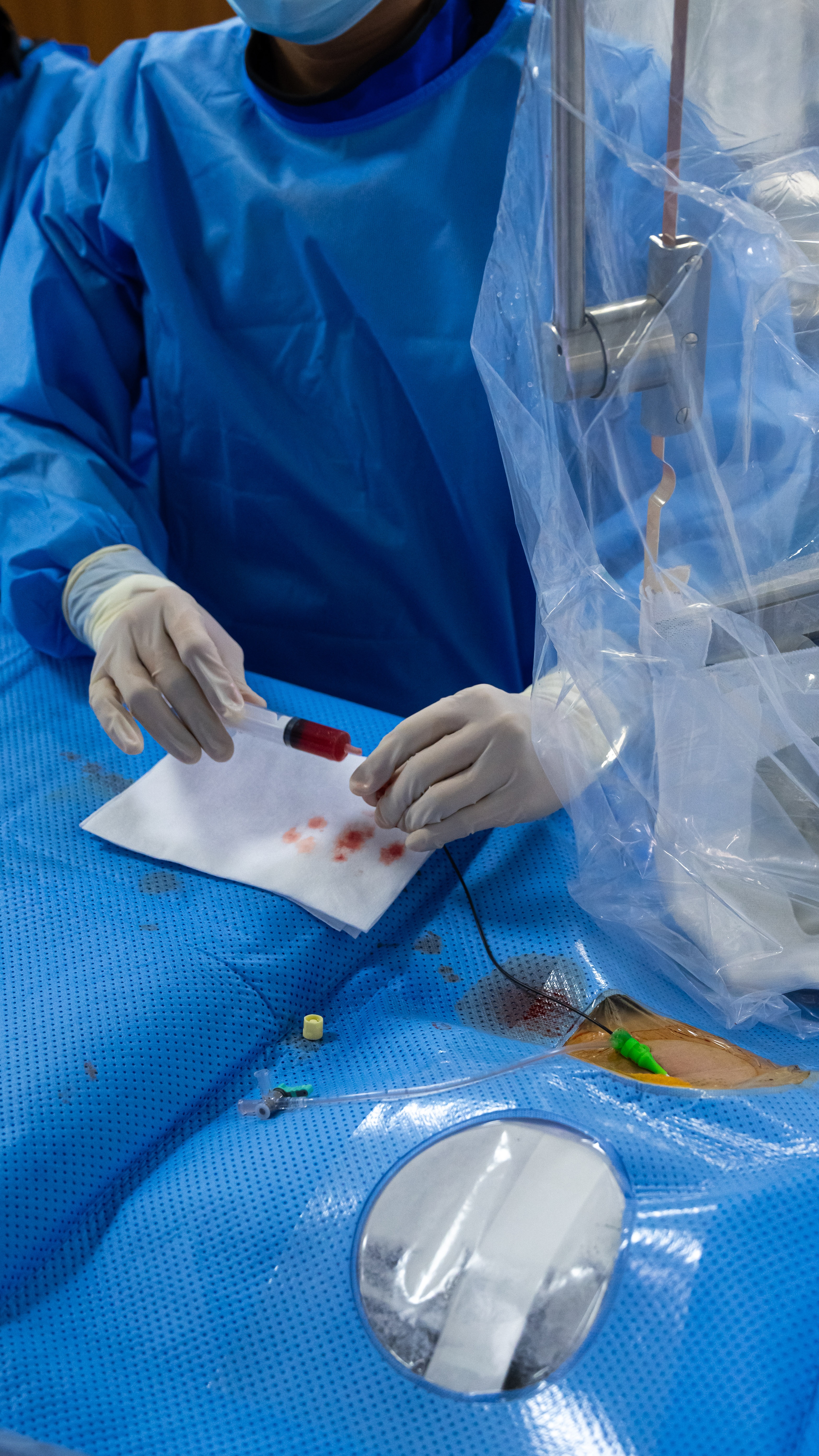 trong phong can thiep nao anh 20