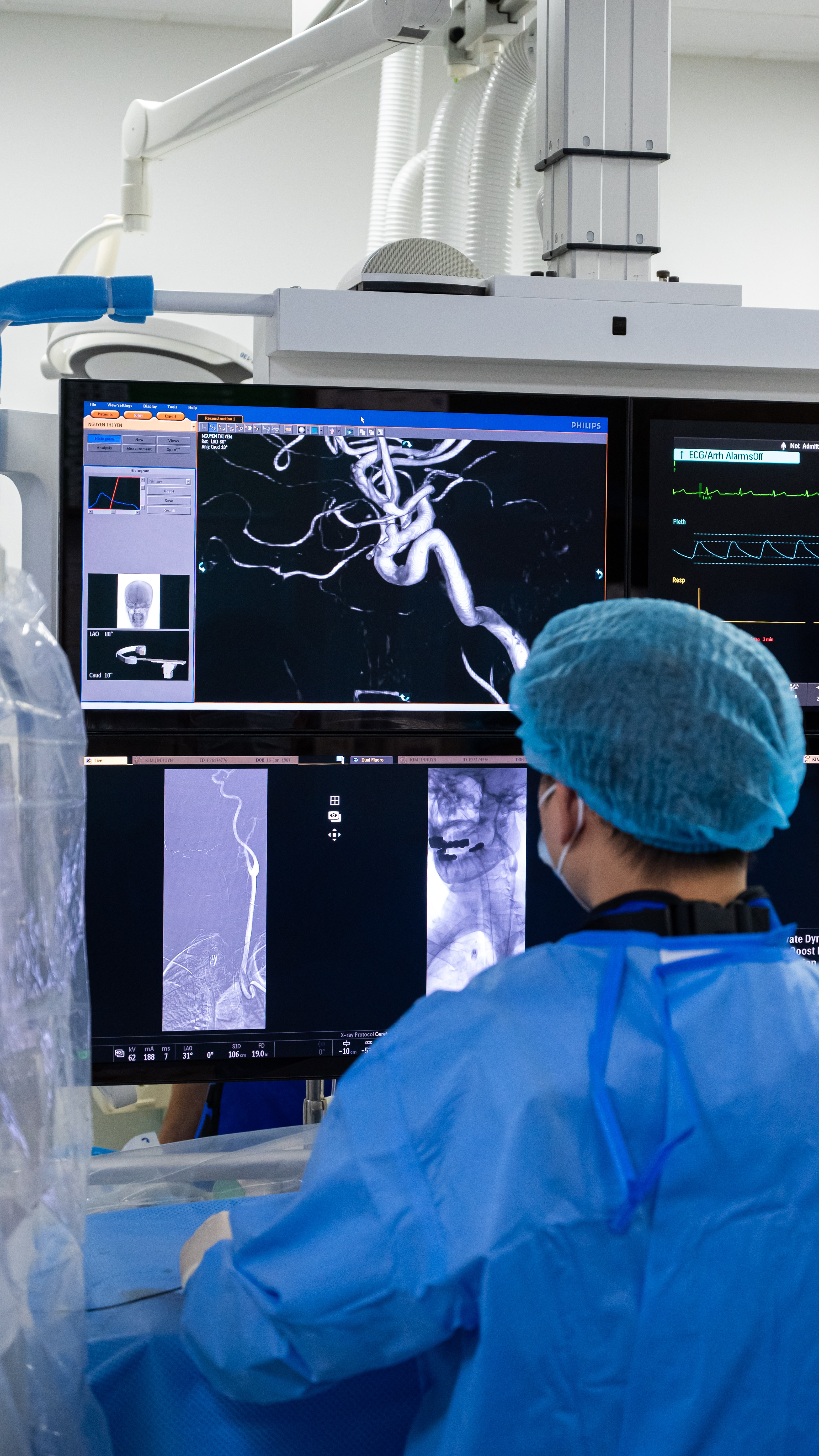 trong phong can thiep nao anh 16