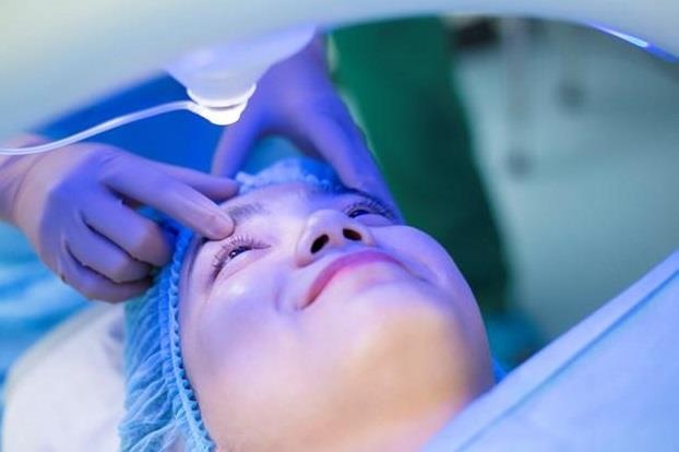 Phuong phap phau thuat khuc xa chi mat 2 ngay hoi phuc hinh anh