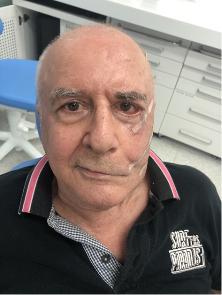 liet day than kinh anh 2