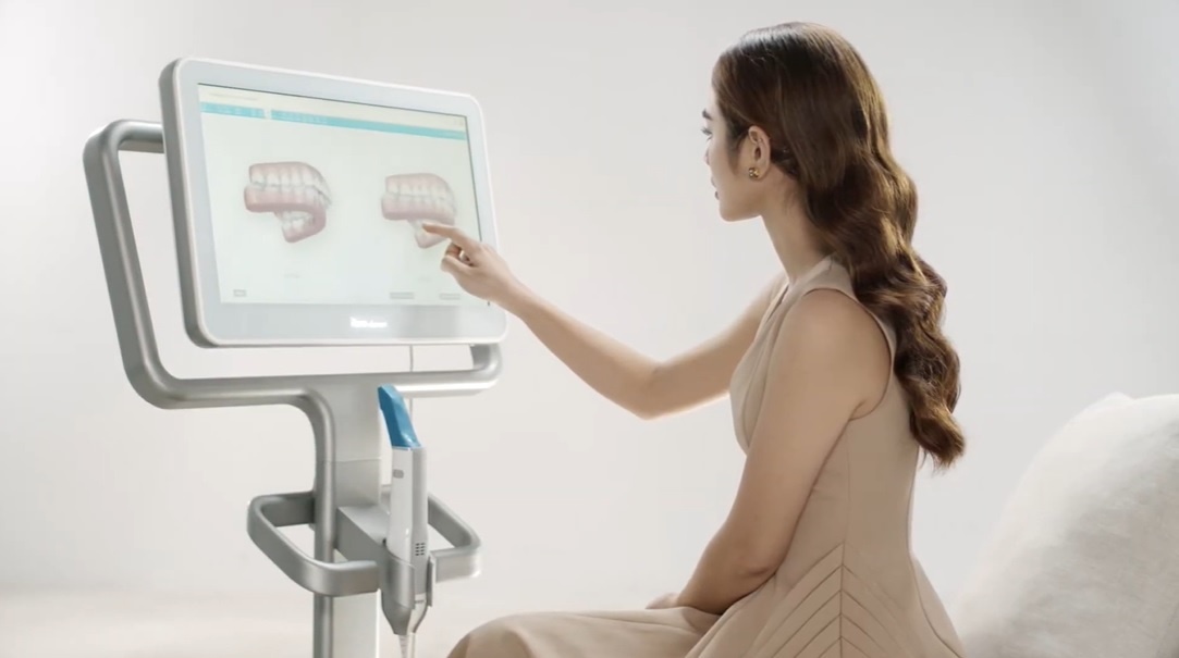 Video nieng Invisalign chuan bach kim - iTero 5D tai Nha khoa Thuy Duc hinh anh