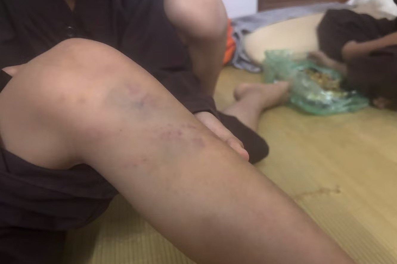 Vụ bạo hành trẻ tại chùa Bầu, Phú Thọ: Nhiều cháu có thương tích