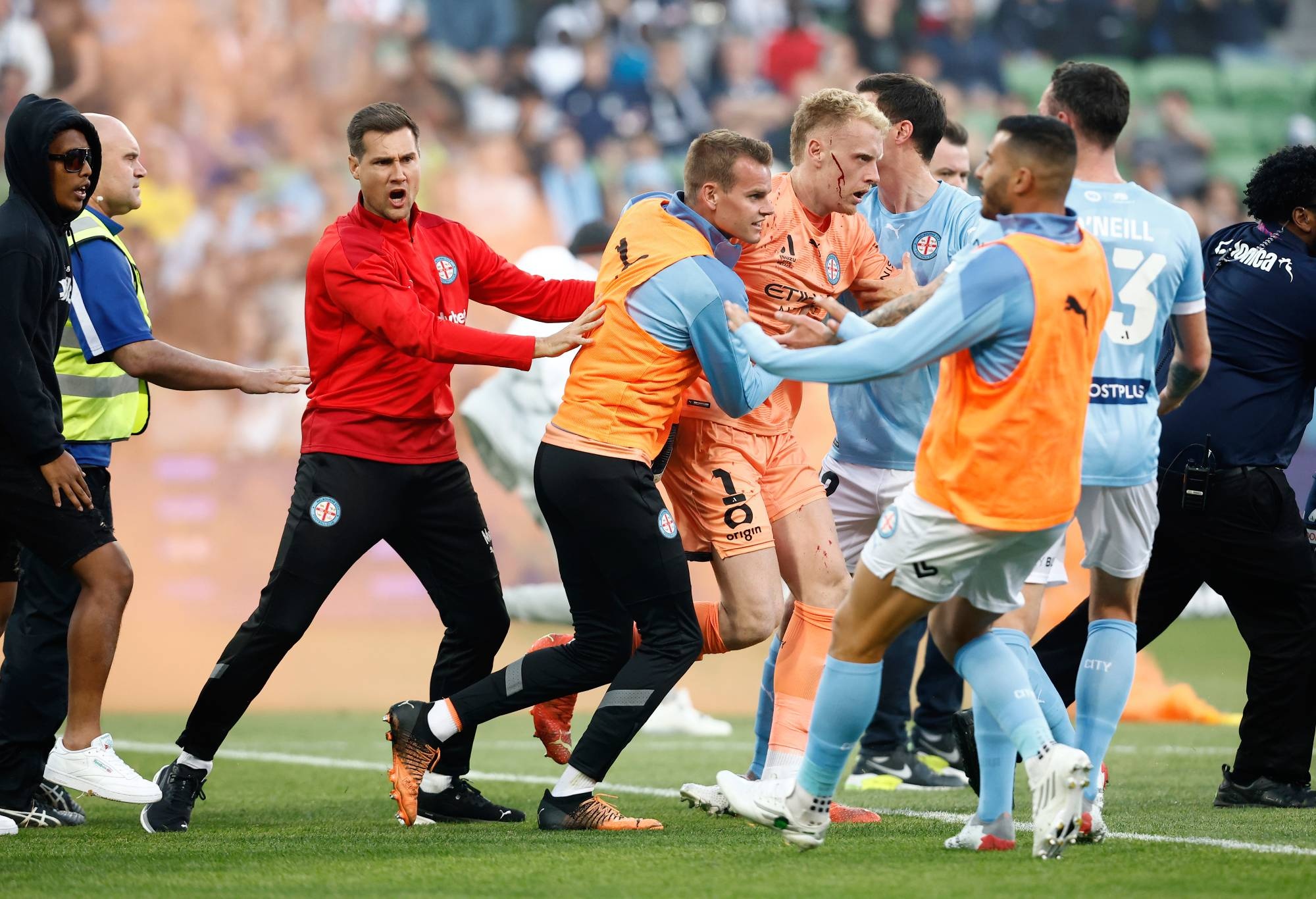 Cu soc sau 'ngay den toi nhat cua nen bong da Australia' hinh anh