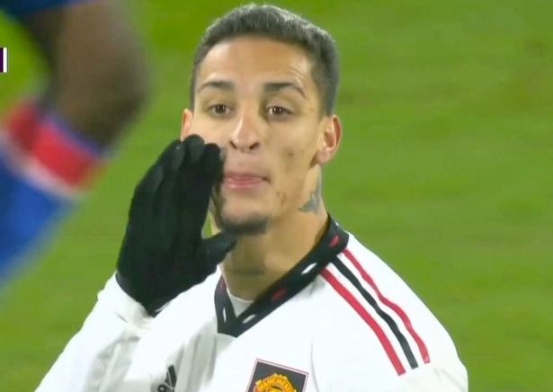 Antony bi to mang Fernandes hinh anh