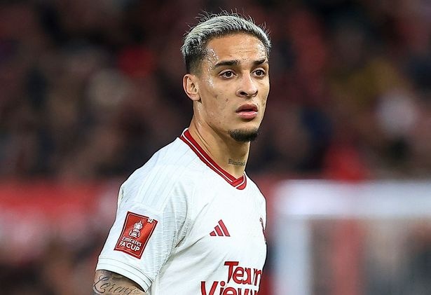 Antony lai bi chi trich hinh anh