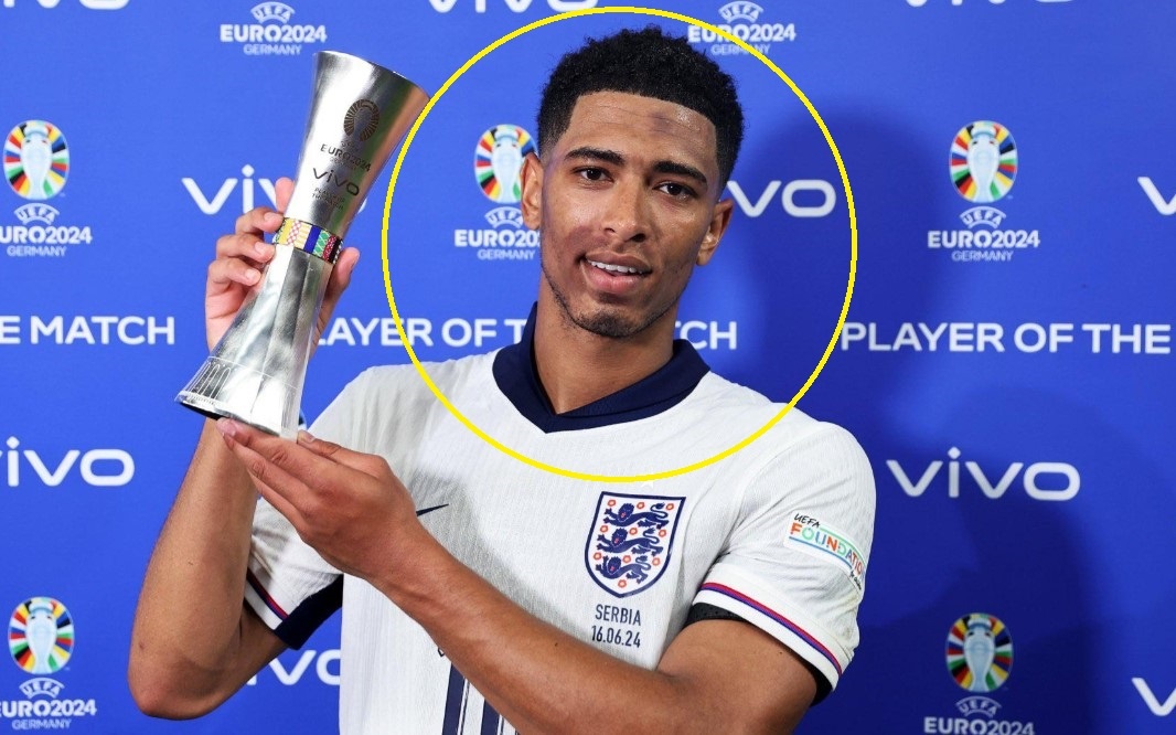 Da mat bat thuong cua Bellingham hinh anh