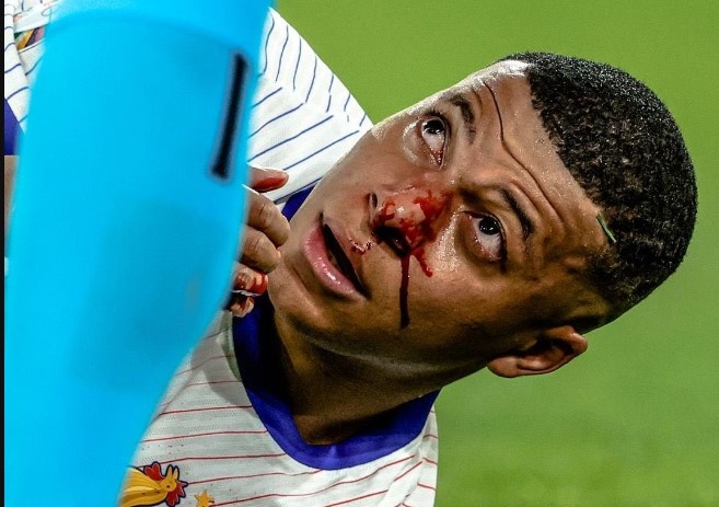 Tuyen Phap ngan Mbappe da tran tiep theo hinh anh