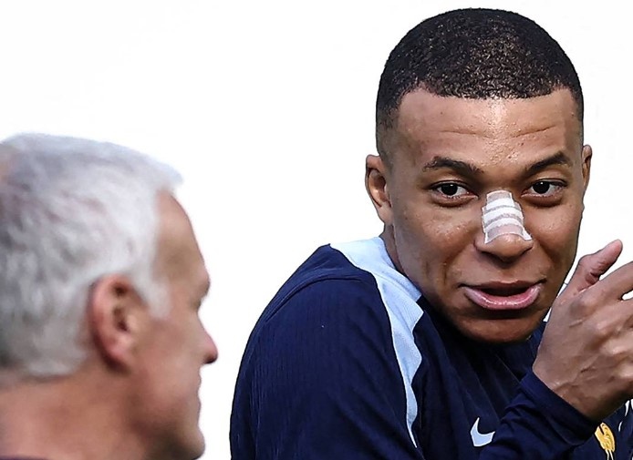 Mbappe tai xuat sau ca gay mui hinh anh