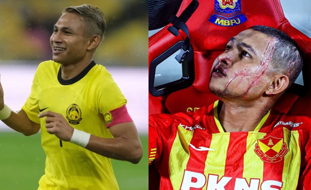 Dien mao gay soc cua sao Malaysia bi tat axit hinh anh