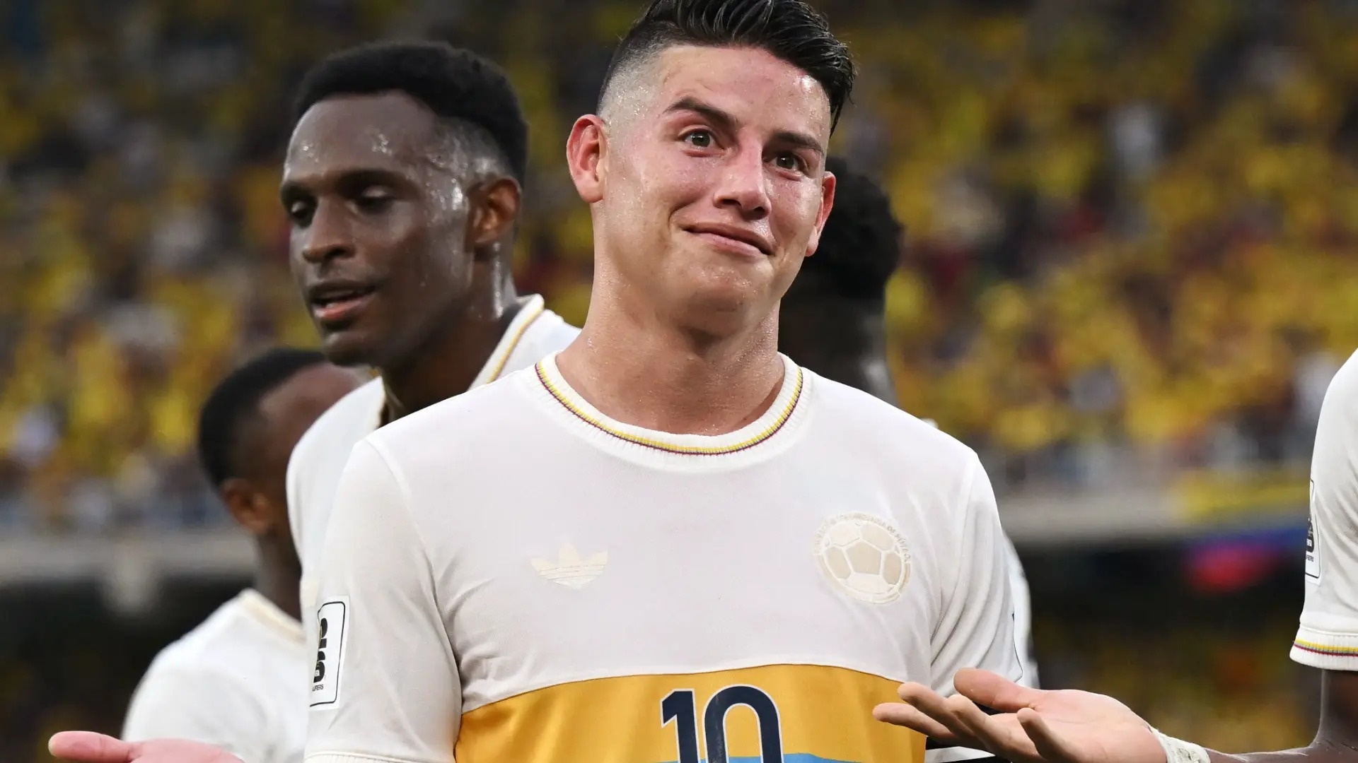 James Rodriguez gay bat ngo lon hinh anh