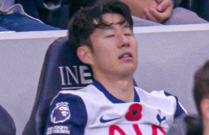 Son to thai do khi bi thay som hinh anh