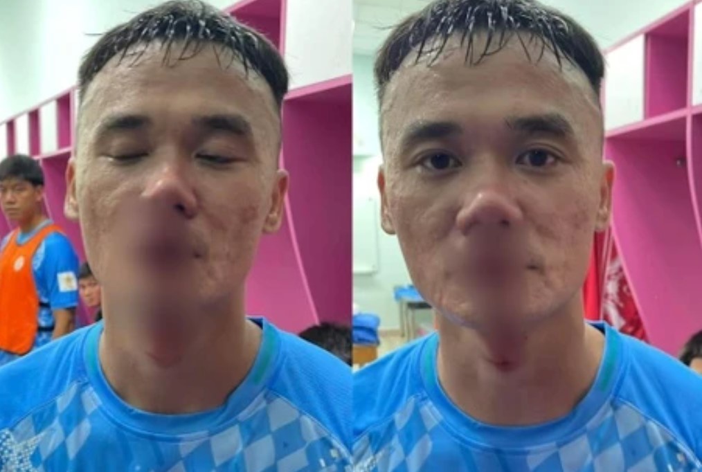 VPF: 'Xuan Nam chu dong gay han' hinh anh