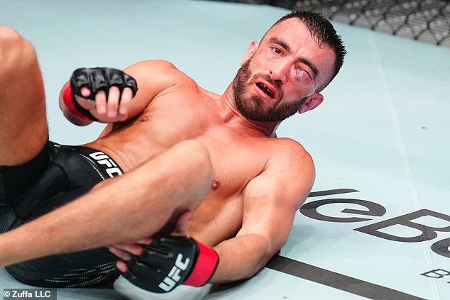 Mat vo si MMA bien dang vi don nang hinh anh