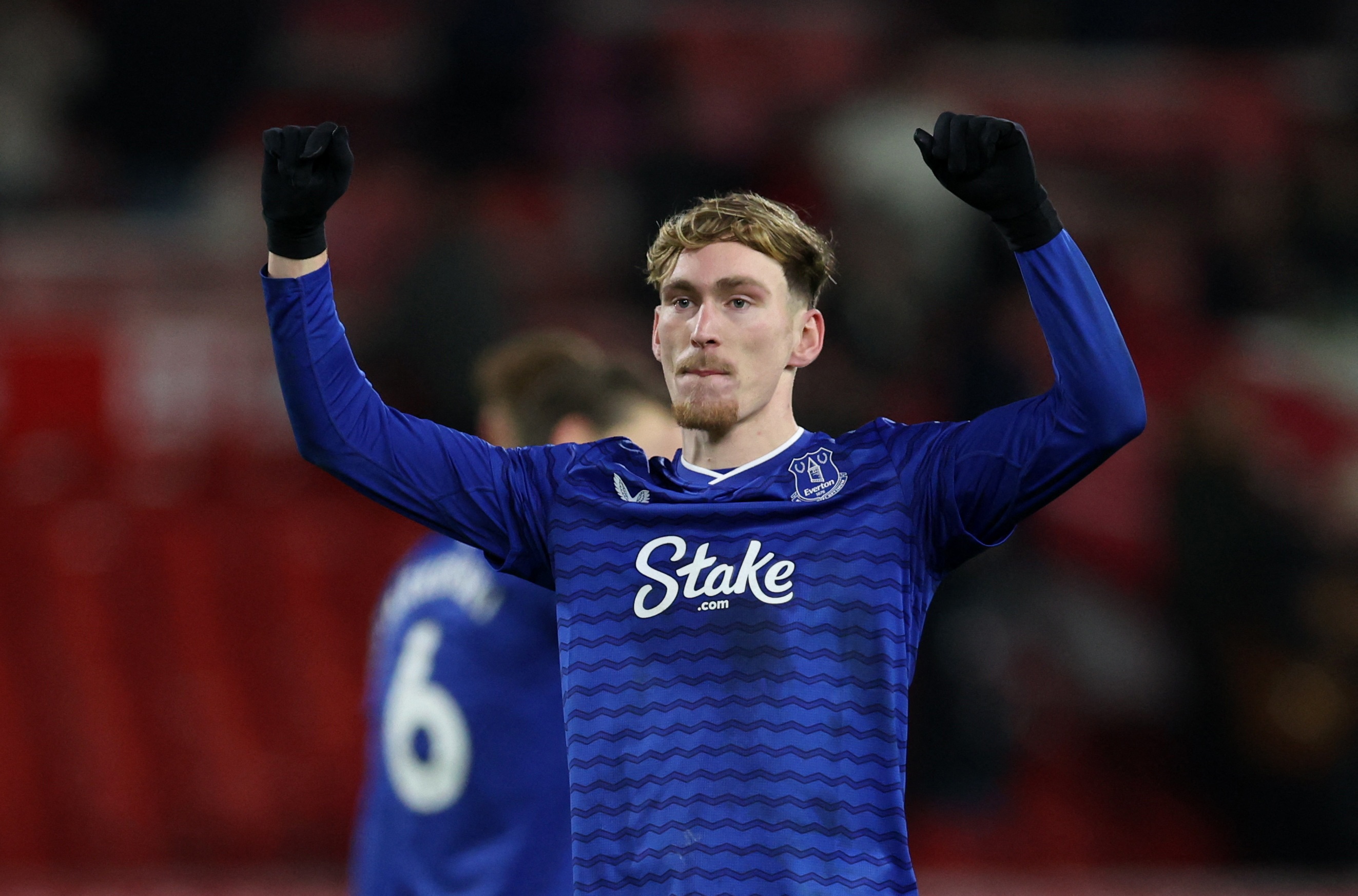 MU phai sua sai voi James Garner hinh anh