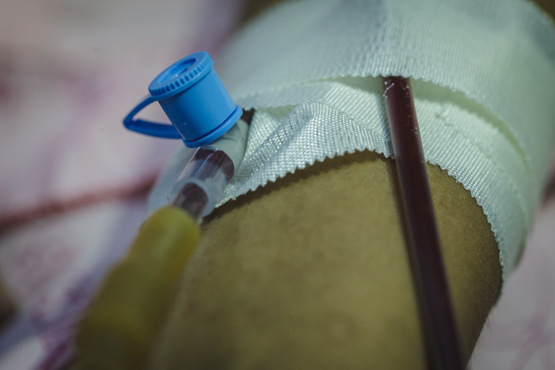 Hanh trinh chong choi can benh ung thu mau cua Kieu hinh anh