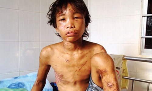 Nhung vu bao hanh tre em rung dong bi dua ra xet xu hinh anh