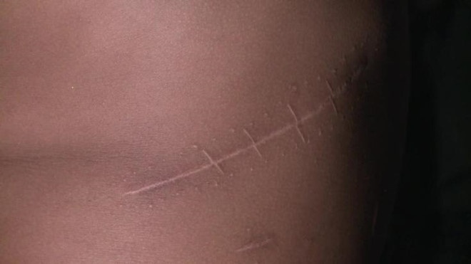 mua ban than bi xu ly the nao anh 1