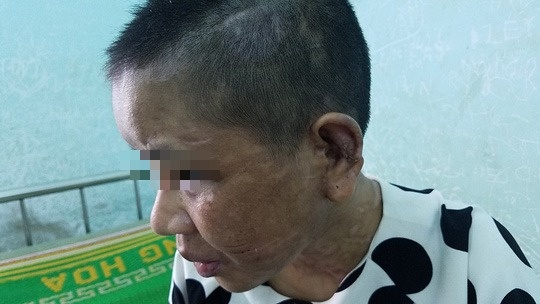 Vu 9X lam thue bi bao hanh: Phuong tuong chi va cham binh thuong hinh anh