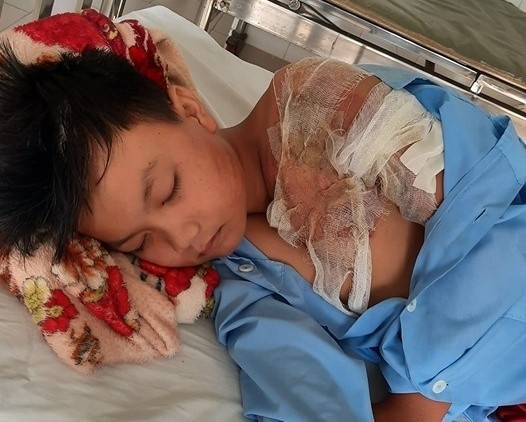 cha tạt nước sôi con trai ảnh 1 cha tat nuoc soi con trai anh 1