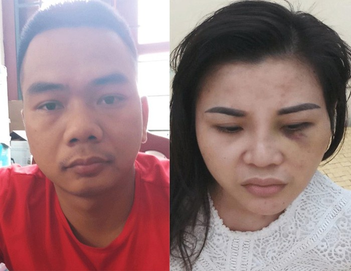 Bat nhom cuop dung chieu 'my nu' de du nan nhan vao nha nghi hinh anh