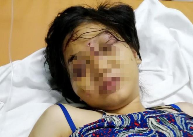 tra tấn cô gái sẩy thai ảnh 1 tra tan co gai say thai anh 1