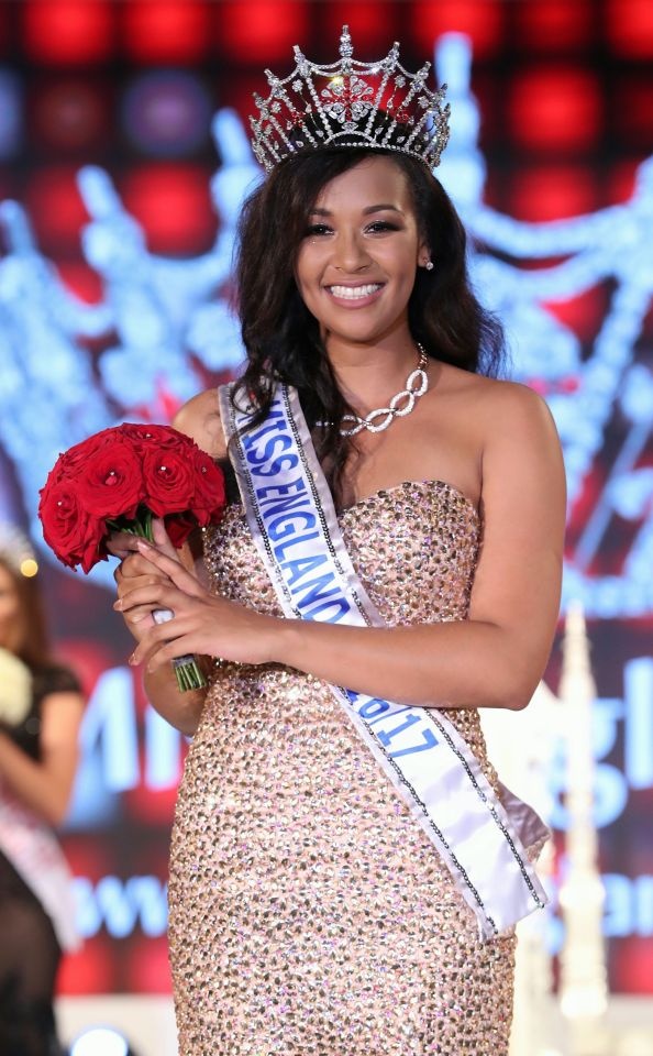 Hoa hậu Anh bị chê tròn trịa ảnh 4 Hoa hau Anh bi che tron tria anh 4