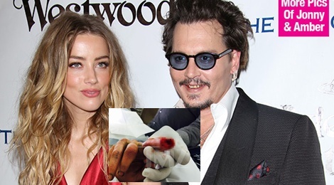 Johnny Depp tu cat dut dau ngon tay khi nghi vo ngoai tinh hinh anh