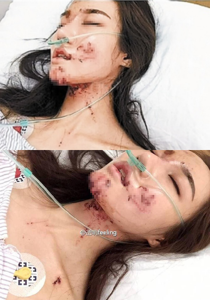 MC tai nan tren BMW anh 1