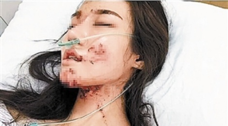 MC Trung Quoc bi tai nan bien dang mat hinh anh