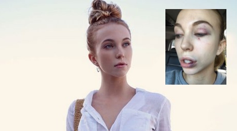 Thi sinh Hoa hau Hoan vu bi danh hoi dong o nha ve sinh hinh anh