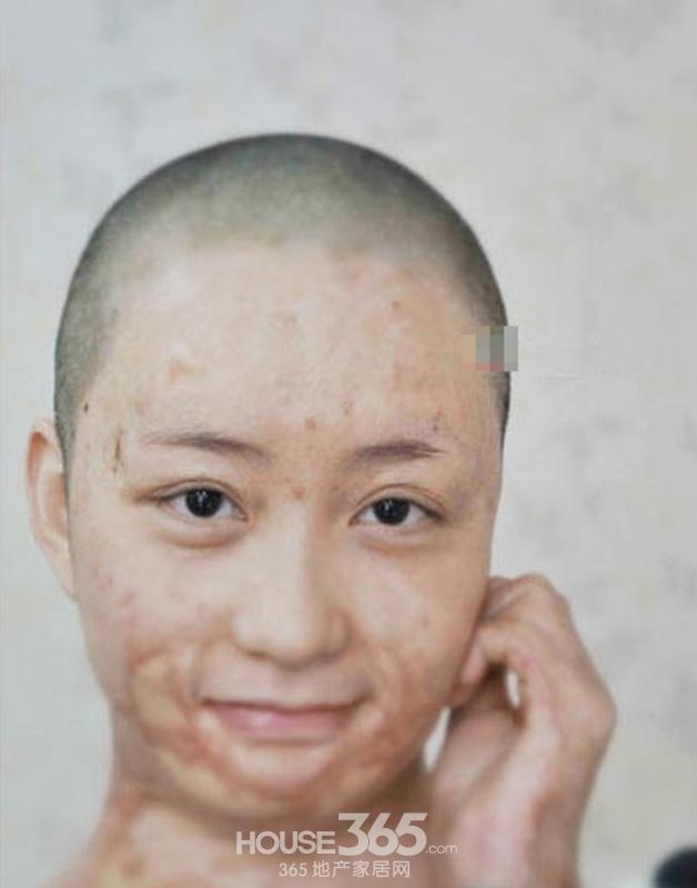 Nguoi mau Hoa ngu bi thieu song anh 10