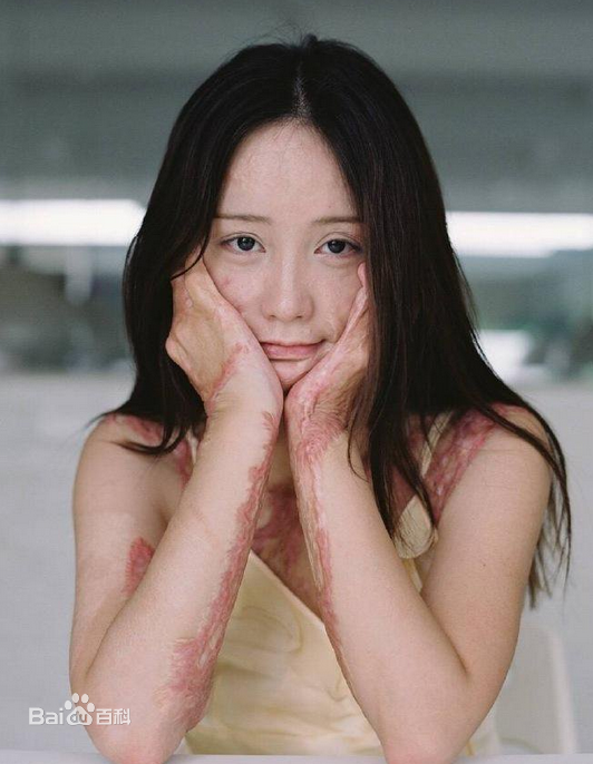 Nguoi mau Hoa ngu bi thieu song anh 1