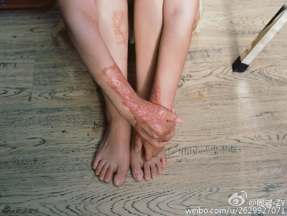 Nguoi mau Hoa ngu bi thieu song anh 4