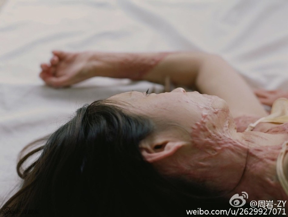 Nguoi mau Hoa ngu bi thieu song anh 5