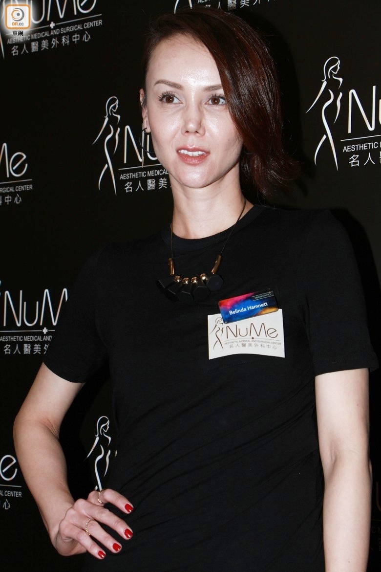 Hoa hậu bị mũi lệch ảnh 1 Hoa hau bi mui lech anh 1