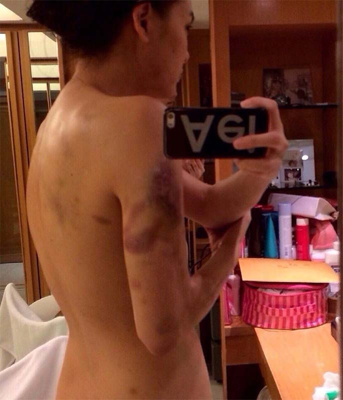 Mỹ nhân Thái Lan bị đánh sau ly hôn ảnh 2 My nhan Thai Lan bi danh sau ly hon anh 2