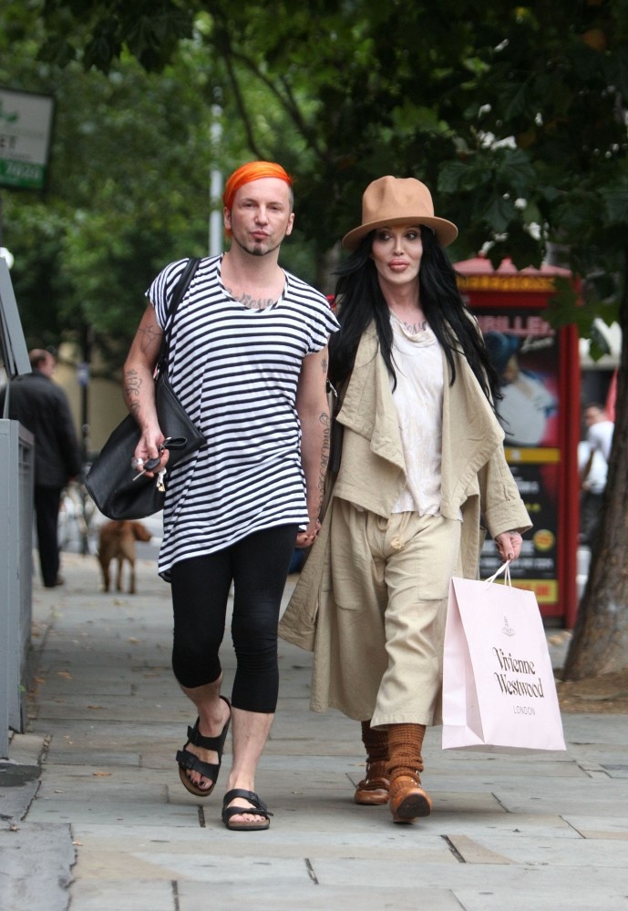 Ca sĩ Pete Burns qua đời ảnh 3 Ca si Pete Burns qua doi anh 3