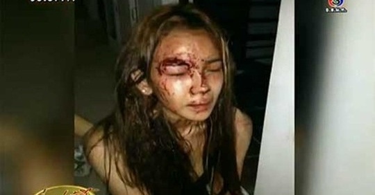 Sao nu Thai Lan tram cam sau khi suyt bi tho xay cuong buc hinh anh