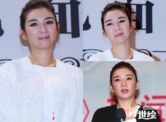 Giai nhan Trung Quoc mat bien dang khi tiem botox qua da hinh anh