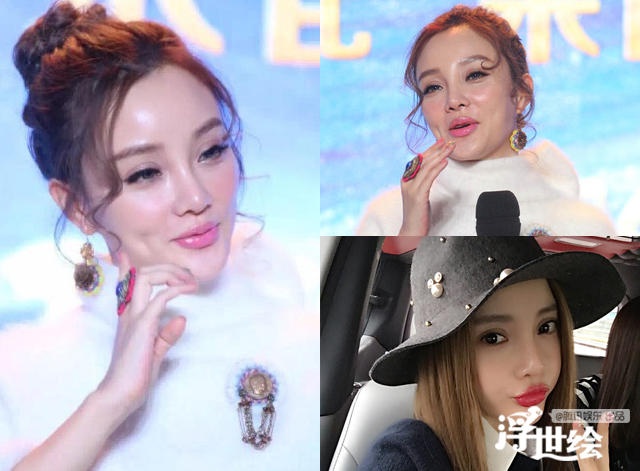 Hau qua sao Hoa ngu khi botox qua da anh 2