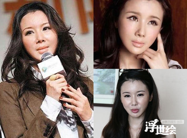 Hau qua sao Hoa ngu khi botox qua da anh 4