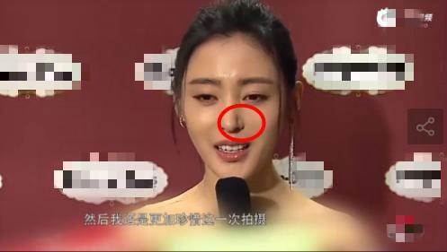 Sao nu 'Thai tu phi thang chuc ky' lo mui la bi nghi dao keo hinh anh