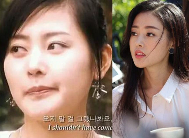 Trương Thiên Ái thẩm mỹ ảnh 2 Truong Thien Ai tham my anh 2