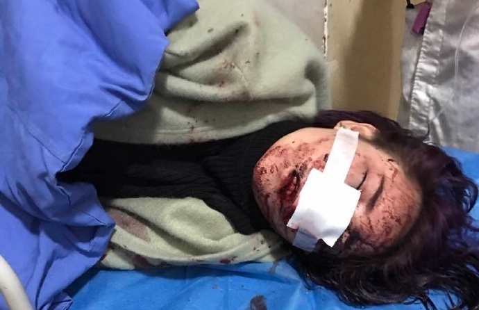 Trung Quoc xon xao vu mau tre bi 12 nguoi dan ong hanh hung hinh anh