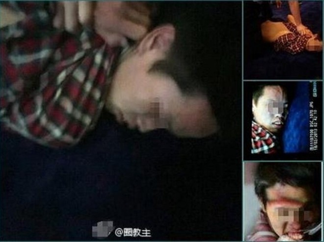 10 vu sao quoc te bi tan cong,  hanh hung anh 8