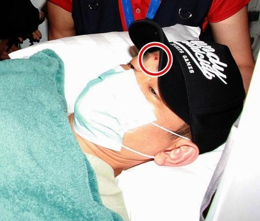 Luu Duc Hoa can den 7 nguoi cham soc tai benh vien hinh anh